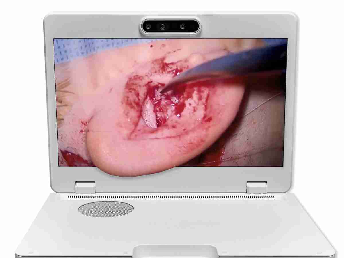 达擎之＂Heads-up 3D显微手术显示系统＂，，，，整合4K裸眼3D显示及眼球追踪系统，，，，具备快速追踪人眼移动位置功能，，减轻医师长时间维持固定姿势的负担，，，让医师能有更宽广清晰的3D立体视野及更舒适的姿势来执行手术。。。。